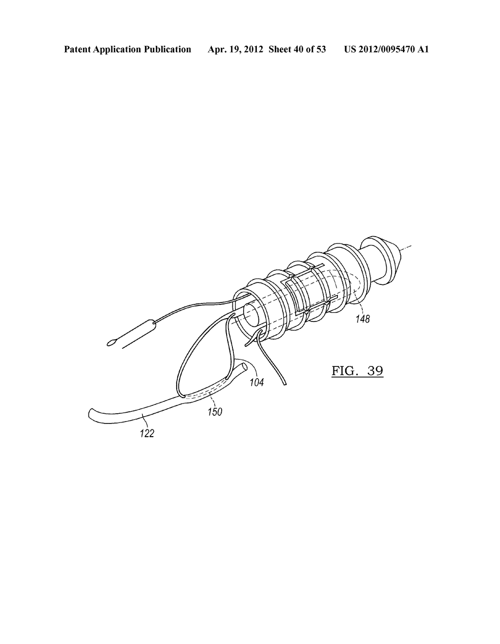 Method and Apparatus for Coupling Soft Tissue to a Bone - diagram, schematic, and image 41