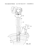 Method and Apparatus for Coupling Soft Tissue to a Bone diagram and image