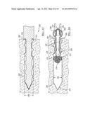 Method and Apparatus for Coupling Soft Tissue to a Bone diagram and image