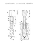 Method and Apparatus for Coupling Soft Tissue to a Bone diagram and image