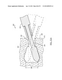 Method and Apparatus for Coupling Soft Tissue to a Bone diagram and image