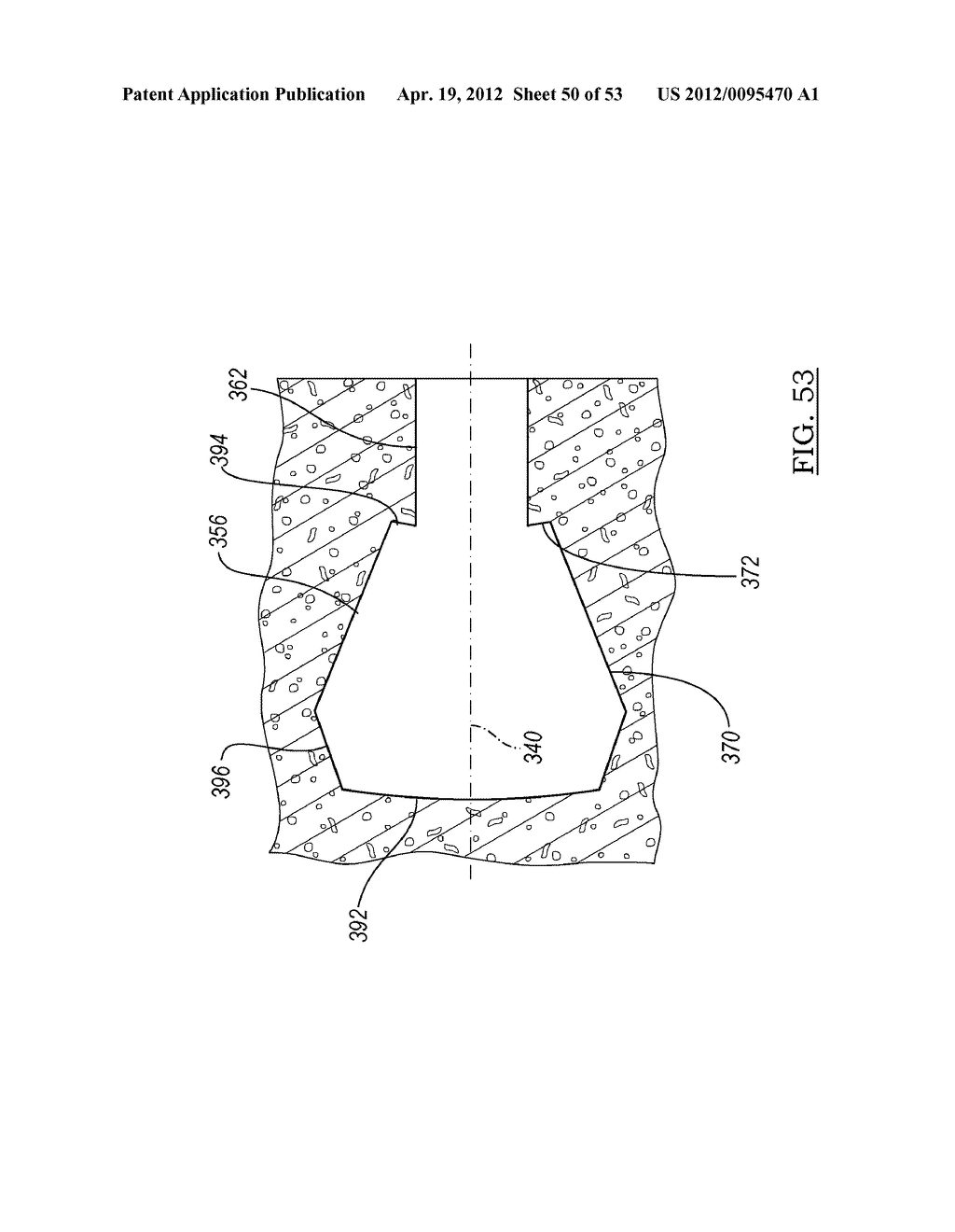 Method and Apparatus for Coupling Soft Tissue to a Bone - diagram, schematic, and image 51