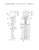 Method and Apparatus for Coupling Soft Tissue to a Bone diagram and image