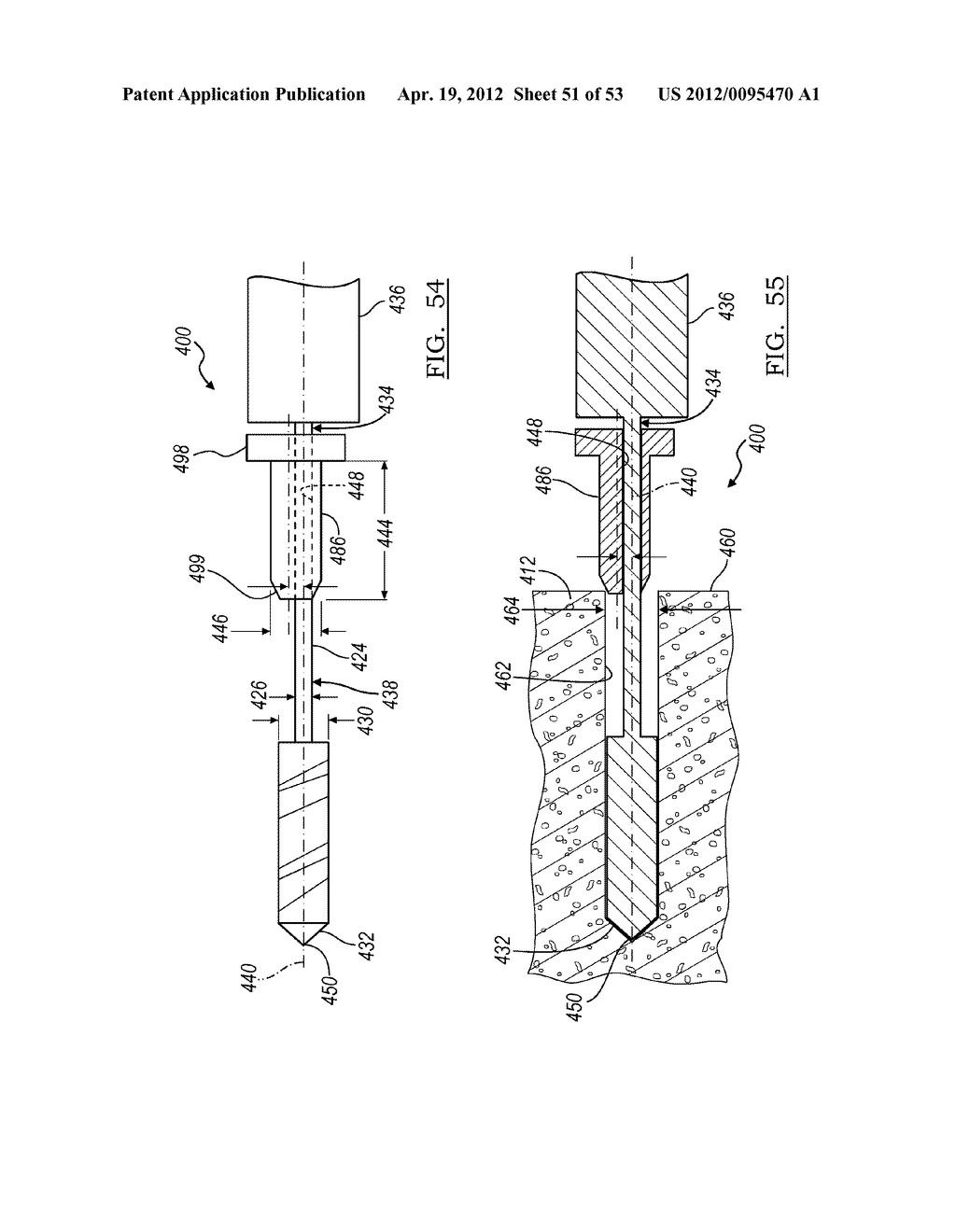 Method and Apparatus for Coupling Soft Tissue to a Bone - diagram, schematic, and image 52