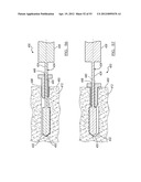 Method and Apparatus for Coupling Soft Tissue to a Bone diagram and image