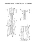 Method and Apparatus for Coupling Soft Tissue to a Bone diagram and image