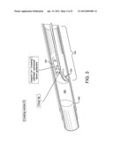 SYSTEMS AND METHODS FOR PERCUTANEOUS OCCLUSION CROSSING diagram and image