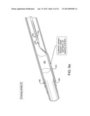 SYSTEMS AND METHODS FOR PERCUTANEOUS OCCLUSION CROSSING diagram and image