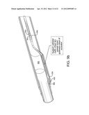 SYSTEMS AND METHODS FOR PERCUTANEOUS OCCLUSION CROSSING diagram and image