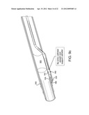 SYSTEMS AND METHODS FOR PERCUTANEOUS OCCLUSION CROSSING diagram and image