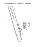 SYSTEMS AND METHODS FOR PERCUTANEOUS OCCLUSION CROSSING diagram and image