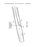 SYSTEMS AND METHODS FOR PERCUTANEOUS OCCLUSION CROSSING diagram and image