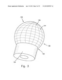 SELF EXPANDABLE MIDDLE EAR IMPLANT FOR TREATING HEARING RELATED DISORDERS diagram and image