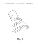 SELF EXPANDABLE MIDDLE EAR IMPLANT FOR TREATING HEARING RELATED DISORDERS diagram and image