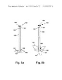 SELF EXPANDABLE MIDDLE EAR IMPLANT FOR TREATING HEARING RELATED DISORDERS diagram and image