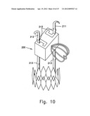 SELF EXPANDABLE MIDDLE EAR IMPLANT FOR TREATING HEARING RELATED DISORDERS diagram and image