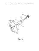 SELF EXPANDABLE MIDDLE EAR IMPLANT FOR TREATING HEARING RELATED DISORDERS diagram and image