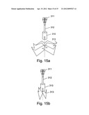 SELF EXPANDABLE MIDDLE EAR IMPLANT FOR TREATING HEARING RELATED DISORDERS diagram and image