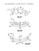 Method And Apparatus For Wrist Arthroplasty diagram and image