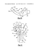 Method And Apparatus For Wrist Arthroplasty diagram and image
