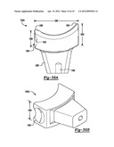 Method And Apparatus For Wrist Arthroplasty diagram and image