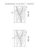 Gated Image Acquisition and Patient Model Construction diagram and image