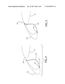 Autonomous Slat-Cove-Filler Device for Reduction of Aeroacoustic Noise     Associated with Aircraft Systems diagram and image