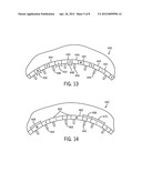 ROTARY MACHINE HAVING GROOVES FOR CONTROL OF FLUID DYNAMICS diagram and image