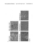 REGIONALISED ENDODERM CELLS AND USES THEREOF diagram and image