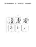 THE USE OF INHIBITORS OF BRUTON S TYROSINE KINASE (BTK) diagram and image