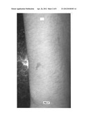 Topical base and active agent-containing compositions, and methods for     improving and treating skin diagram and image