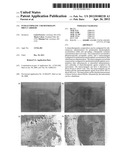 Intralymphatic Chemotherapy Drug Carriers diagram and image