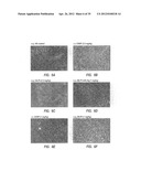 Intralymphatic Chemotherapy Drug Carriers diagram and image