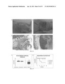 Intralymphatic Chemotherapy Drug Carriers diagram and image