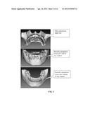 METHOD AND SYSTEM OF ANATOMY MODELING FOR DENTAL IMPLANT TREATMENT     PLANNING diagram and image