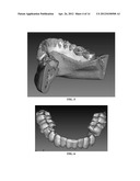 METHOD AND SYSTEM OF ANATOMY MODELING FOR DENTAL IMPLANT TREATMENT     PLANNING diagram and image