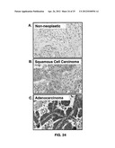 DETECTING CANCER WITH ANTI-CCL25 AND ANTI-CCR9 ANTIBODIES diagram and image