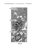 DETECTING CANCER WITH ANTI-CCL25 AND ANTI-CCR9 ANTIBODIES diagram and image