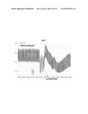 Novel Method For Treating Breathing Disorders or Diseases diagram and image