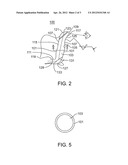 Dolphin Blade/Peri-laryngoscope diagram and image