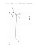 METHODS AND SYSTEMS FOR DETERMINING VASCULAR BODILY LUMEN INFORMATION AND     GUIDING MEDICAL DEVICES diagram and image