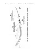 METHODS AND SYSTEMS FOR DETERMINING VASCULAR BODILY LUMEN INFORMATION AND     GUIDING MEDICAL DEVICES diagram and image