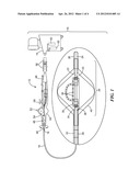 BALLOON CATHETER WITH DEFORMABLE FLUID DELIVERY CONDUIT diagram and image