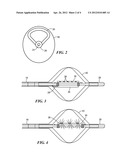 BALLOON CATHETER WITH DEFORMABLE FLUID DELIVERY CONDUIT diagram and image