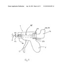 ERGONOMIC HANDPIECE FOR LAPAROSCOPIC AND OPEN SURGERY diagram and image