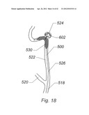 Systems And Methods For Removing Obstructive Matter From Body Lumens And     Treating Vascular Defects diagram and image