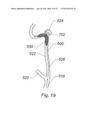 Systems And Methods For Removing Obstructive Matter From Body Lumens And     Treating Vascular Defects diagram and image