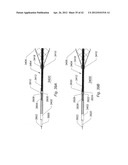 Systems And Methods For Removing Obstructive Matter From Body Lumens And     Treating Vascular Defects diagram and image