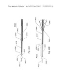 Systems And Methods For Removing Obstructive Matter From Body Lumens And     Treating Vascular Defects diagram and image