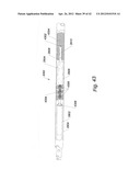 Systems And Methods For Removing Obstructive Matter From Body Lumens And     Treating Vascular Defects diagram and image